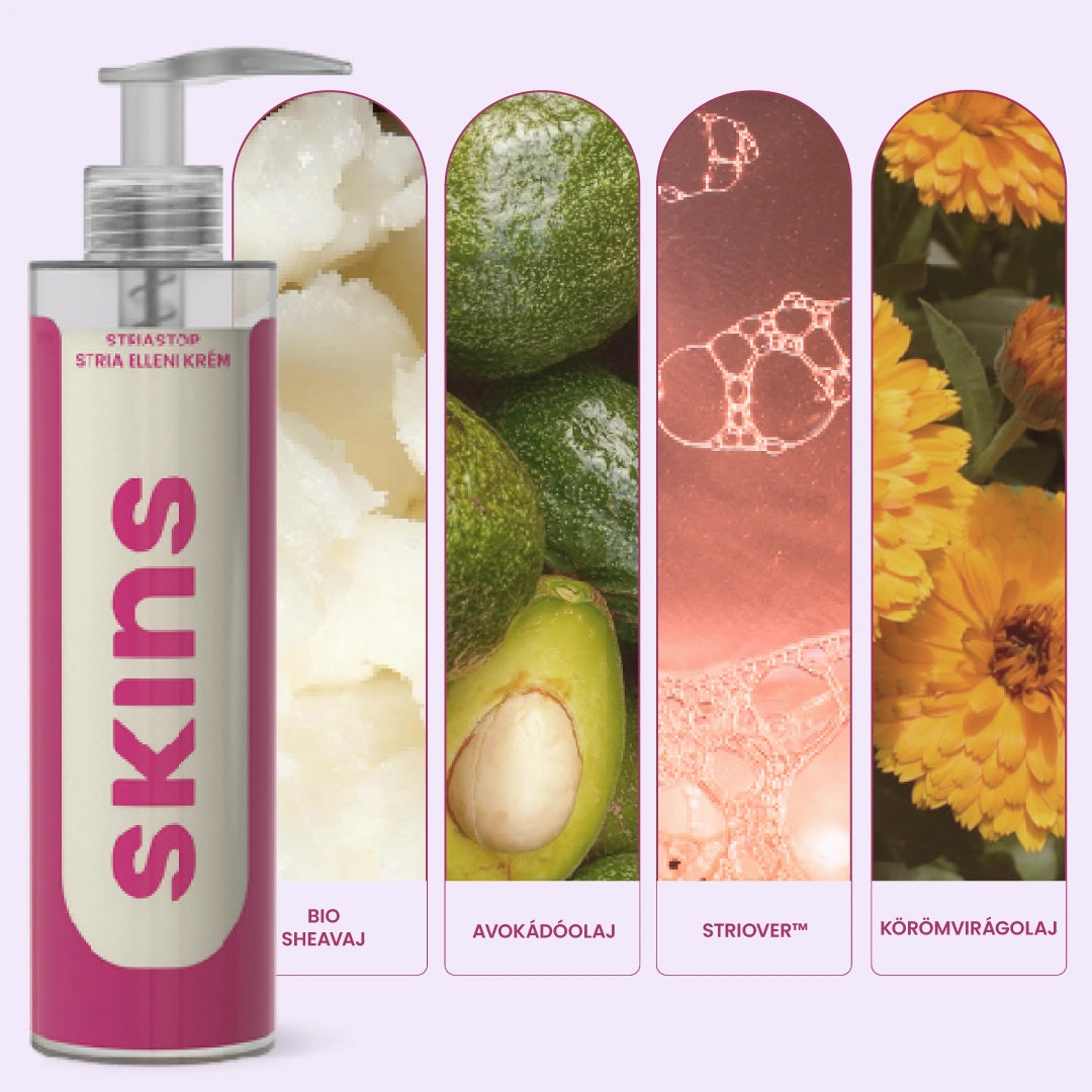 SKINS StriaStop Stria Elleni Krém Striover™ Hatóanyaggal 200ml